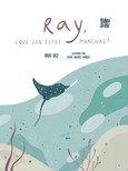 Ray, ¿qué son estas manchas?